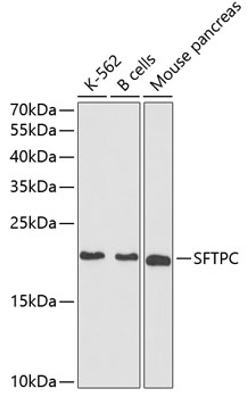 Western blot analysis of extracts of various cell lines, using SFTPC antibody (18-339) at 1:1000 dilution.<br/>Secondary antibody: HRP Goat Anti-Rabbit IgG (H+L) at 1:10000 dilution.<br/>Lysates/proteins: 25ug per lane.<br/>Blocking buffer: 3% nonfat dry milk in TBST.<br/>Detection: ECL Basic Kit.<br/>Exposure time: 90s.
