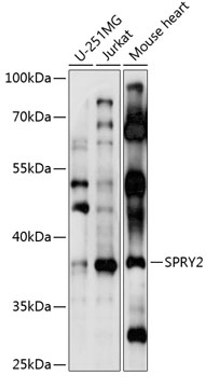 Western blot analysis of extracts of various cell lines, using SPRY2 antibody (18-348) at 1:1000 dilution.<br/>Secondary antibody: HRP Goat Anti-Rabbit IgG (H+L) at 1:10000 dilution.<br/>Lysates/proteins: 25ug per lane.<br/>Blocking buffer: 3% nonfat dry milk in TBST.<br/>Detection: ECL Basic Kit.<br/>Exposure time: 10s.