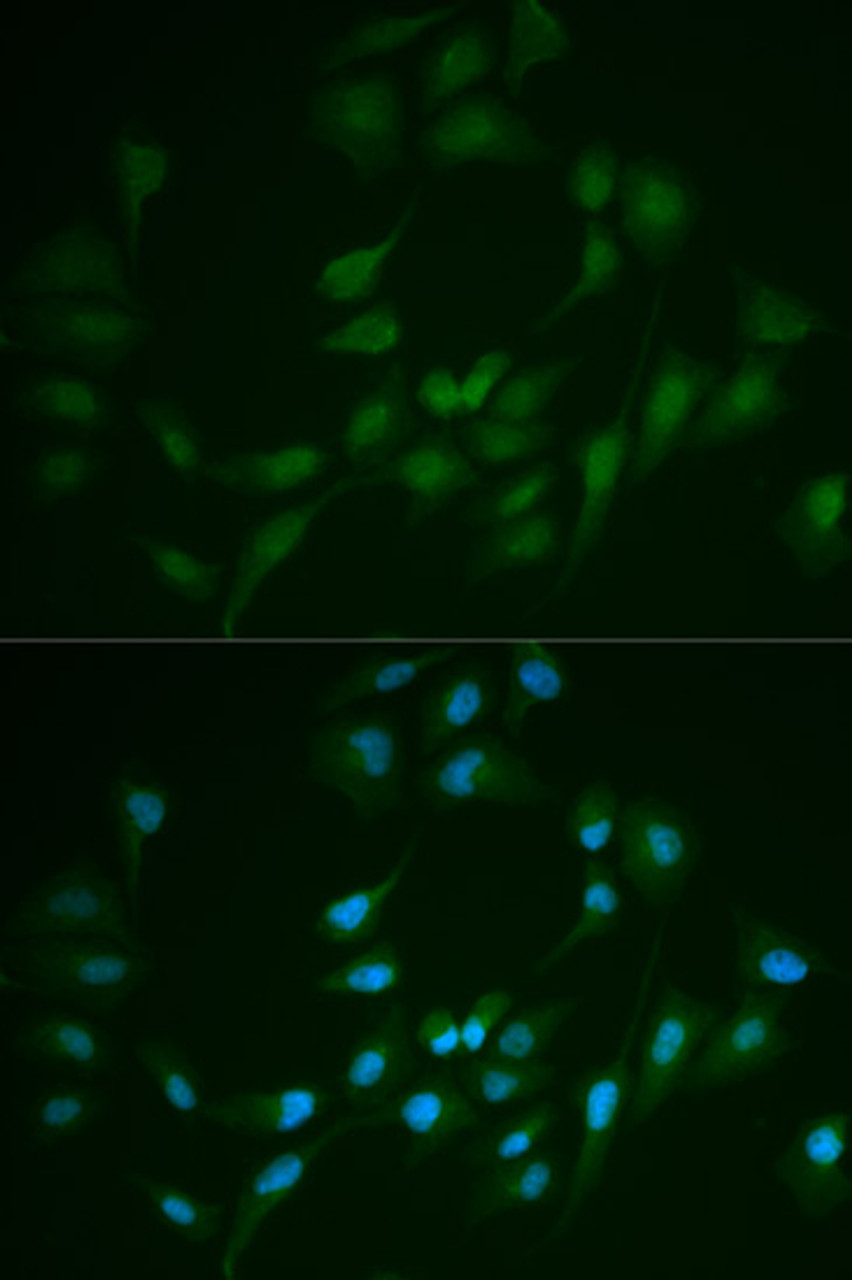 Immunofluorescence analysis of MCF-7 cells using LIG1 antibody (18-351) . Blue: DAPI for nuclear staining.