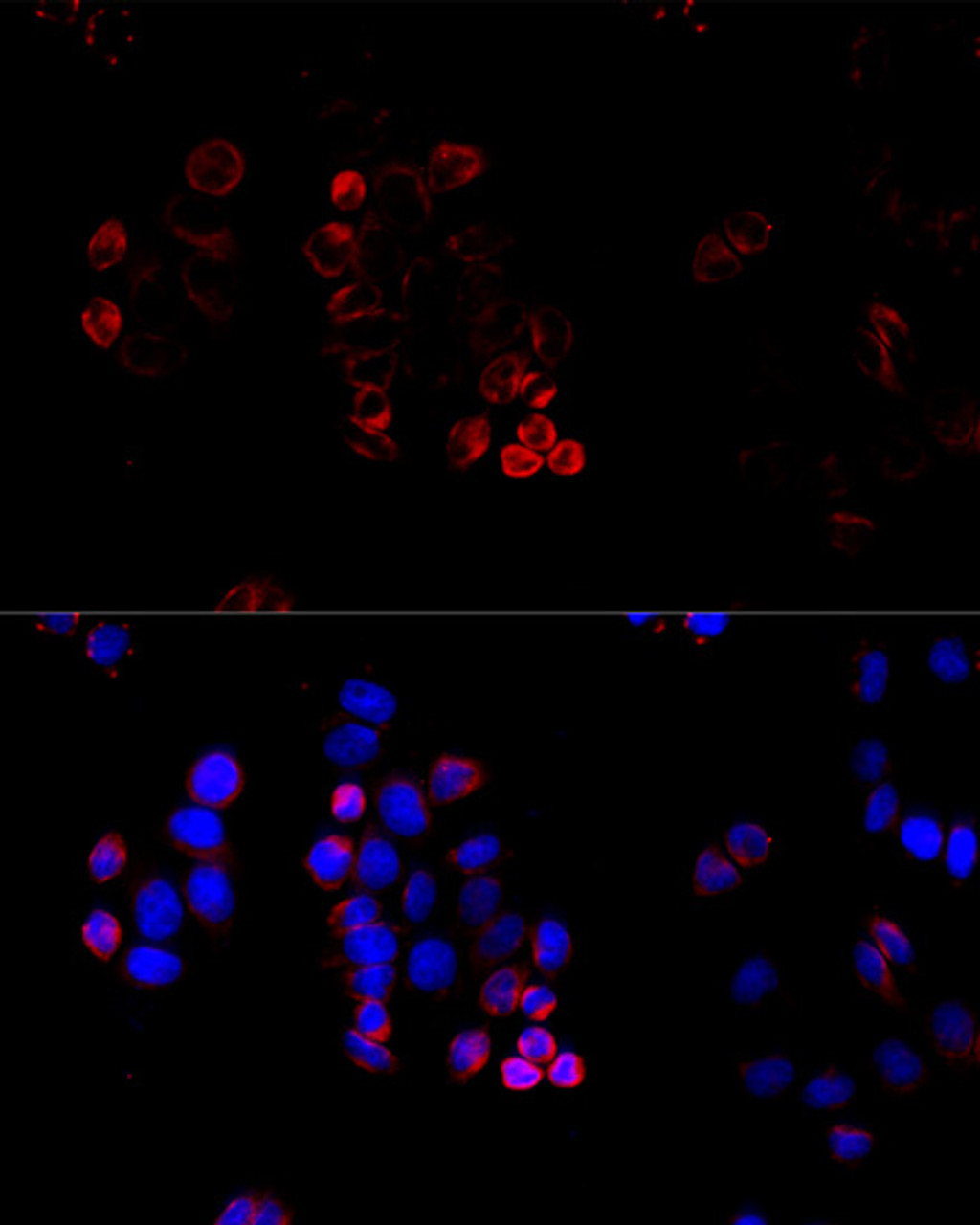 Immunofluorescence analysis of HeLa cells using ABCG8 antibody (18-361) at dilution of 1:100 (40x lens) . Blue: DAPI for nuclear staining.