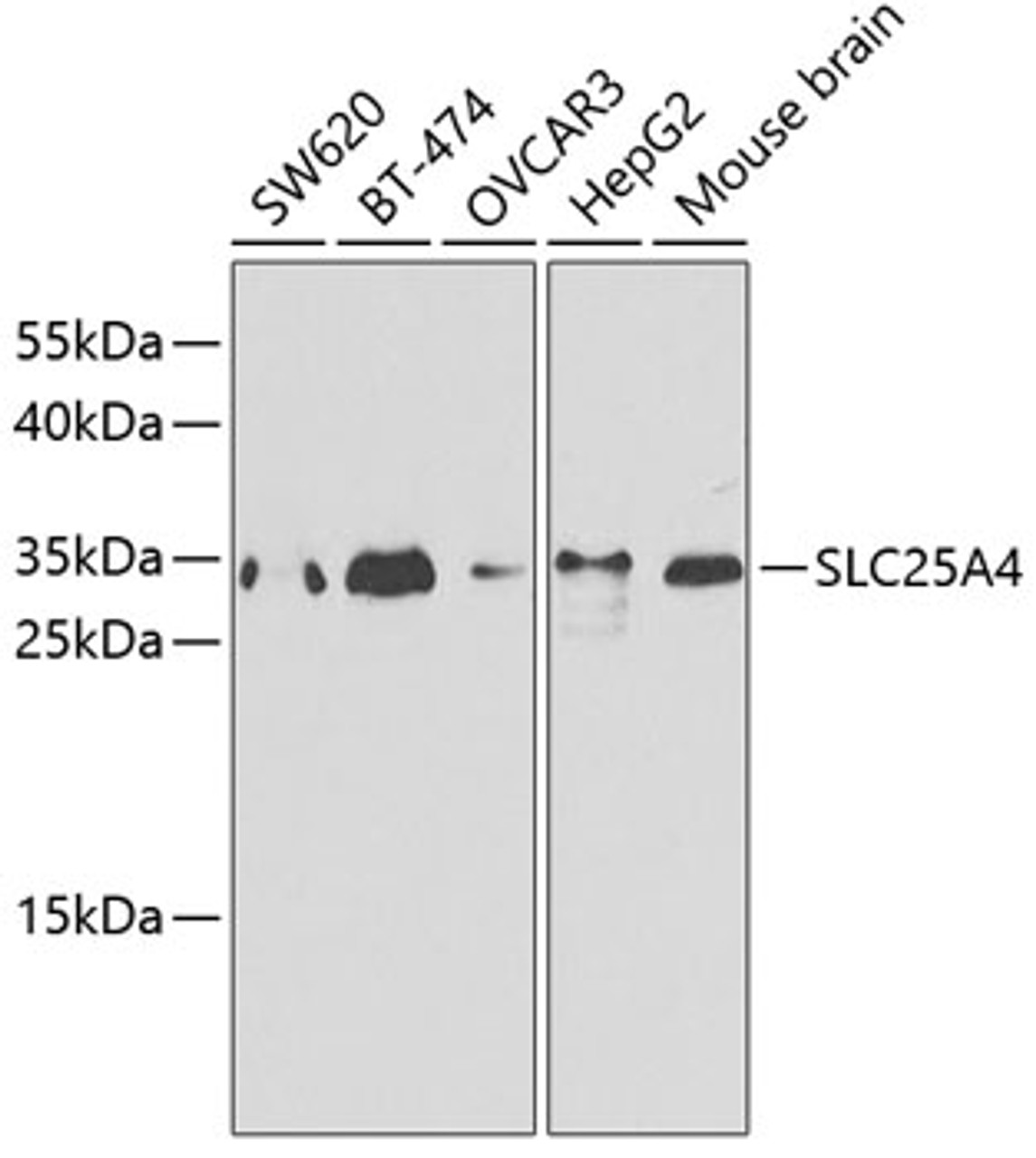 Western blot analysis of extracts of various cell lines, using SLC25A4 antibody (18-362) .<br/>Secondary antibody: HRP Goat Anti-Rabbit IgG (H+L) at 1:10000 dilution.<br/>Lysates/proteins: 25ug per lane.<br/>Blocking buffer: 3% nonfat dry milk in TBST.