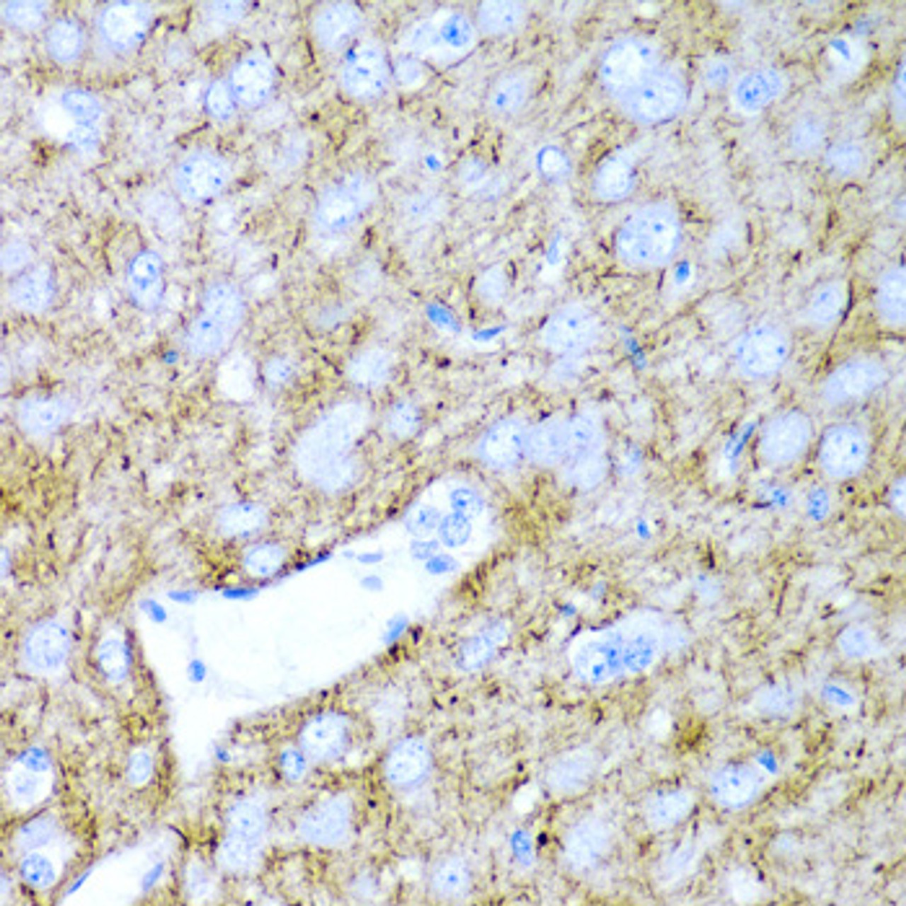 Immunohistochemistry of paraffin-embedded rat brain using PTGDS antibody (18-366) at dilution of 1:200 (40x lens) .
