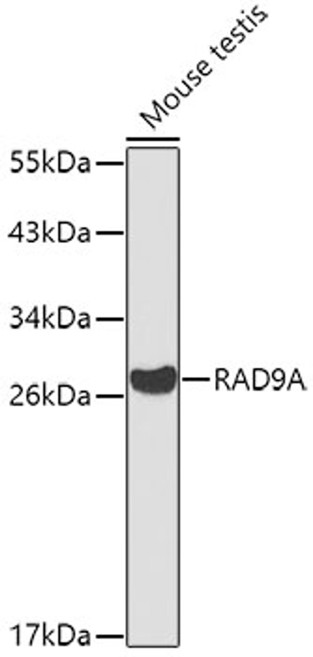 Western blot analysis of extracts of mouse testis, using RAD9A antibody (18-367) at 1:1000 dilution.<br/>Secondary antibody: HRP Goat Anti-Rabbit IgG (H+L) at 1:10000 dilution.<br/>Lysates/proteins: 25ug per lane.<br/>Blocking buffer: 3% nonfat dry milk in TBST.