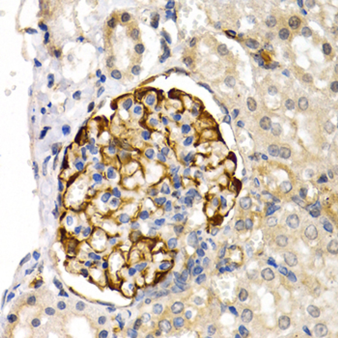 Immunohistochemistry of paraffin-embedded rat kidney using LIPG antibody (18-368) at dilution of 1:200 (40x lens) .