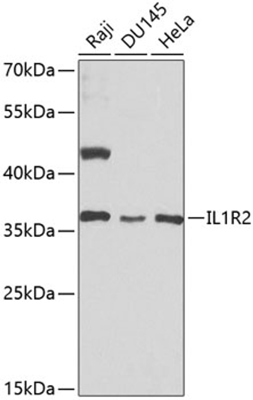 Western blot analysis of extracts of various cell lines, using IL1R2 antibody (18-370) at 1:1000 dilution.<br/>Secondary antibody: HRP Goat Anti-Rabbit IgG (H+L) at 1:10000 dilution.<br/>Lysates/proteins: 25ug per lane.<br/>Blocking buffer: 3% nonfat dry milk in TBST.<br/>Detection: ECL Basic Kit.<br/>Exposure time: 30s.