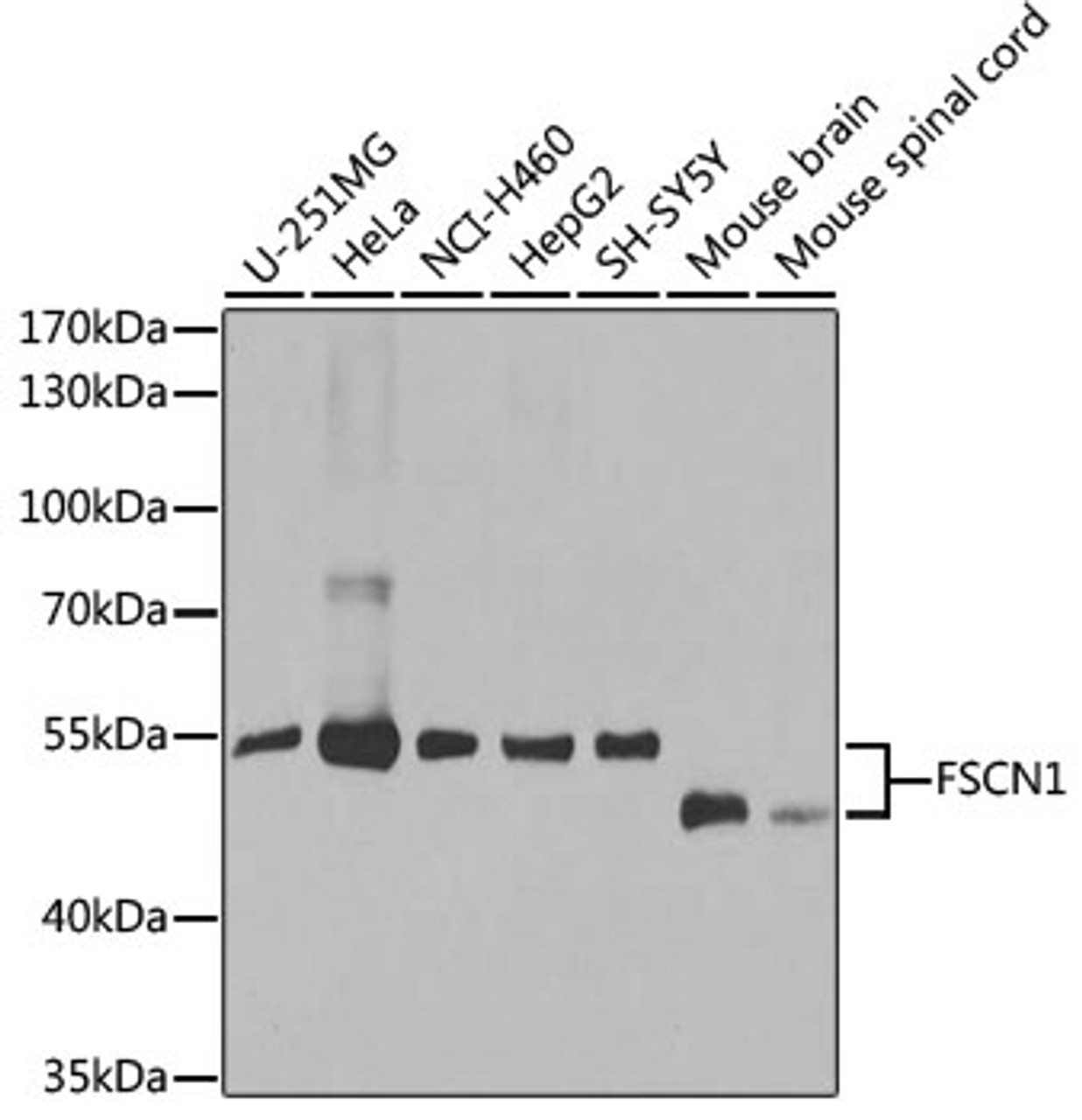 Western blot analysis of extracts of various cell lines, using FSCN1 antibody (18-373) at 1:1000 dilution.<br/>Secondary antibody: HRP Goat Anti-Rabbit IgG (H+L) at 1:10000 dilution.<br/>Lysates/proteins: 25ug per lane.<br/>Blocking buffer: 3% nonfat dry milk in TBST.<br/>Detection: ECL Basic Kit.<br/>Exposure time: 30s.