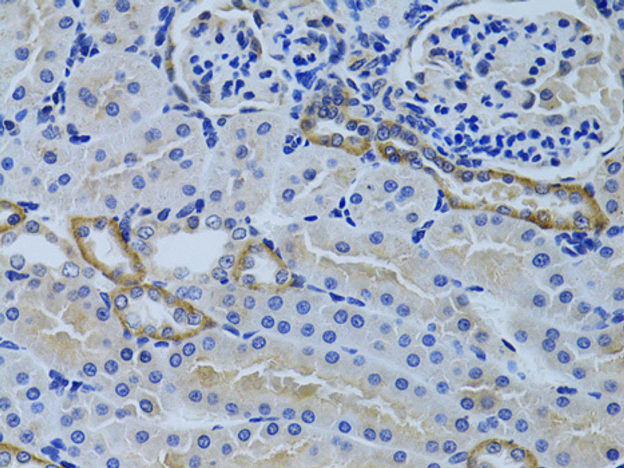 Immunohistochemistry of paraffin-embedded rat kidney using FHL2 antibody (18-376) at dilution of 1:100 (40x lens) .