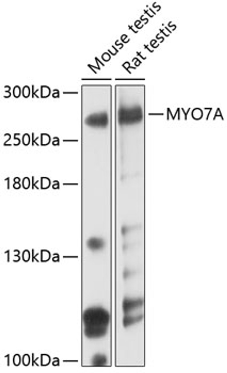 Western blot analysis of extracts of various cell lines, using MYO7A antibody (18-378) at 1:3000 dilution.<br/>Secondary antibody: HRP Goat Anti-Rabbit IgG (H+L) at 1:10000 dilution.<br/>Lysates/proteins: 25ug per lane.<br/>Blocking buffer: 3% nonfat dry milk in TBST.<br/>Detection: ECL Basic Kit.<br/>Exposure time: 30s.