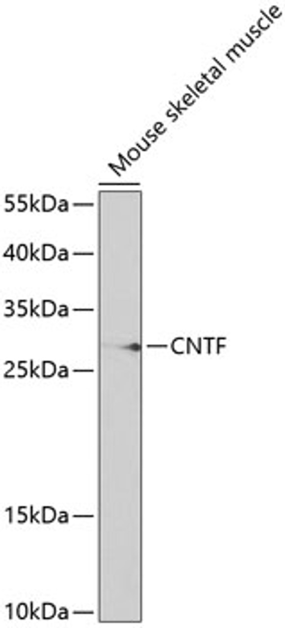 Western blot analysis of extracts of mouse muscle, using CNTF antibody (18-382) at 1:1000 dilution.<br/>Secondary antibody: HRP Goat Anti-Rabbit IgG (H+L) at 1:10000 dilution.<br/>Lysates/proteins: 25ug per lane.<br/>Blocking buffer: 3% nonfat dry milk in TBST.