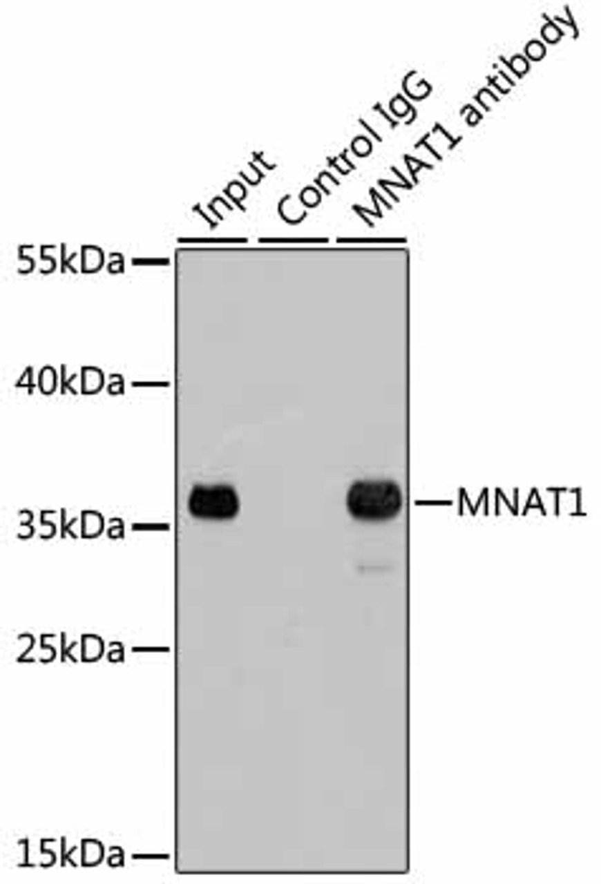 Immunoprecipitation analysis of 200ug extracts of 293T cells using 1ug MNAT1 antibody (18-384) . Western blot was performed from the immunoprecipitate using MNAT1 antibody (18-384) at a dilition of 1:1000.