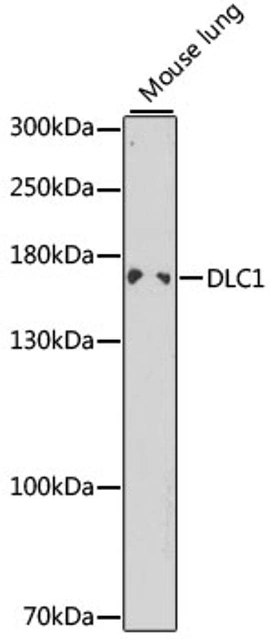 Western blot analysis of extracts of mouse lung, using DLC1 antibody (18-386) at 1:1000 dilution.<br/>Secondary antibody: HRP Goat Anti-Rabbit IgG (H+L) at 1:10000 dilution.<br/>Lysates/proteins: 25ug per lane.<br/>Blocking buffer: 3% nonfat dry milk in TBST.<br/>Detection: ECL Enhanced Kit.