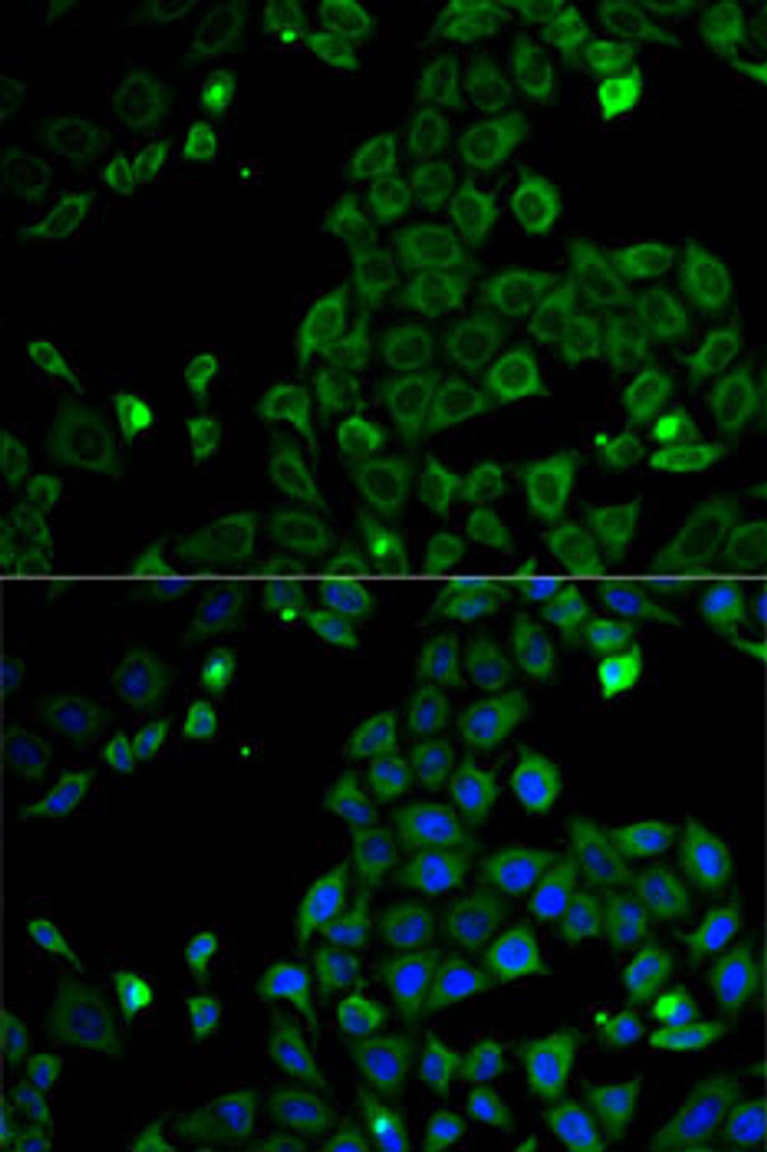 Immunofluorescence analysis of HeLa cells using MSR1 antibody (18-388) . Blue: DAPI for nuclear staining.