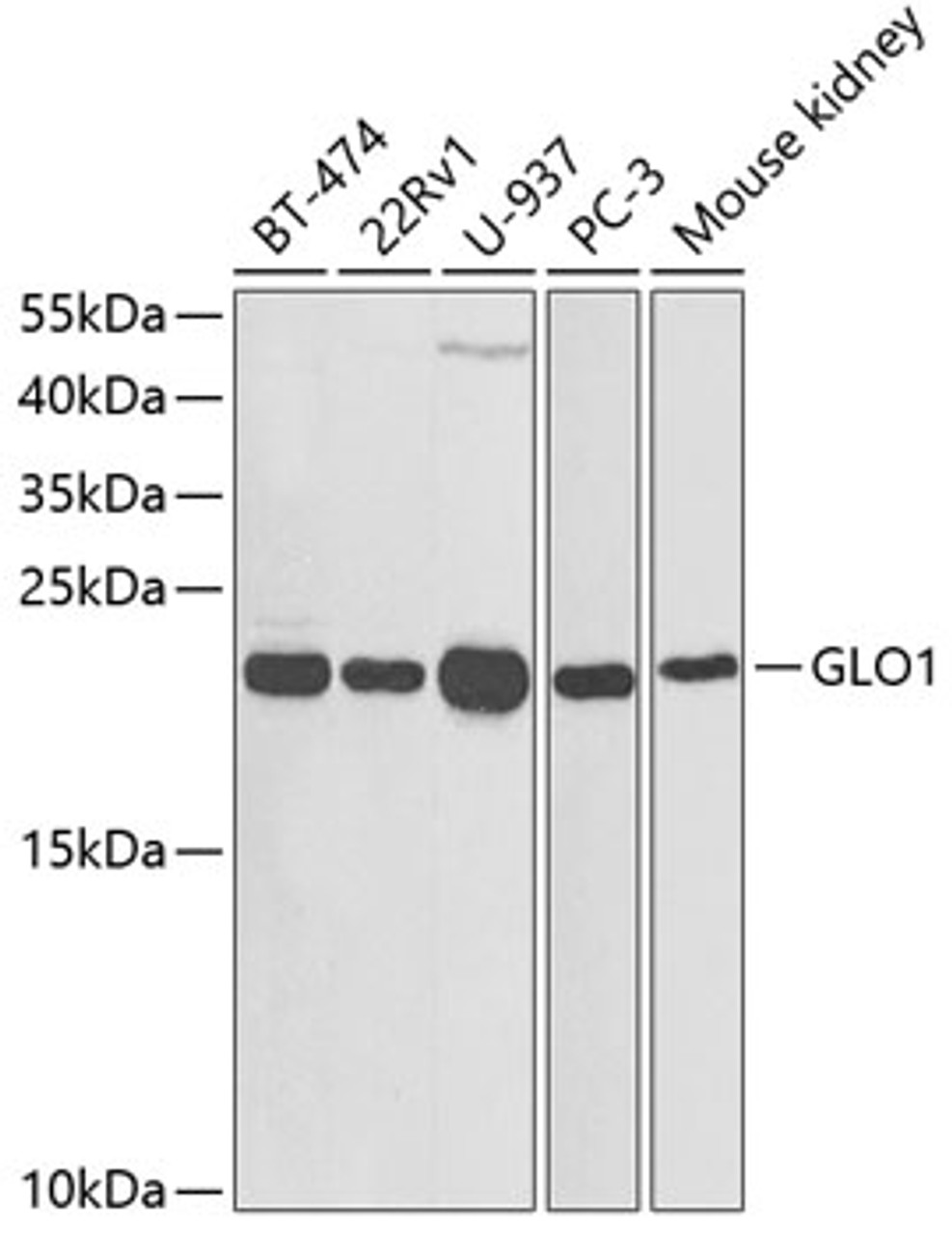 Western blot analysis of extracts of various cell lines, using GLO1 antibody (18-395) at 1:1000 dilution.<br/>Secondary antibody: HRP Goat Anti-Rabbit IgG (H+L) at 1:10000 dilution.<br/>Lysates/proteins: 25ug per lane.<br/>Blocking buffer: 3% nonfat dry milk in TBST.