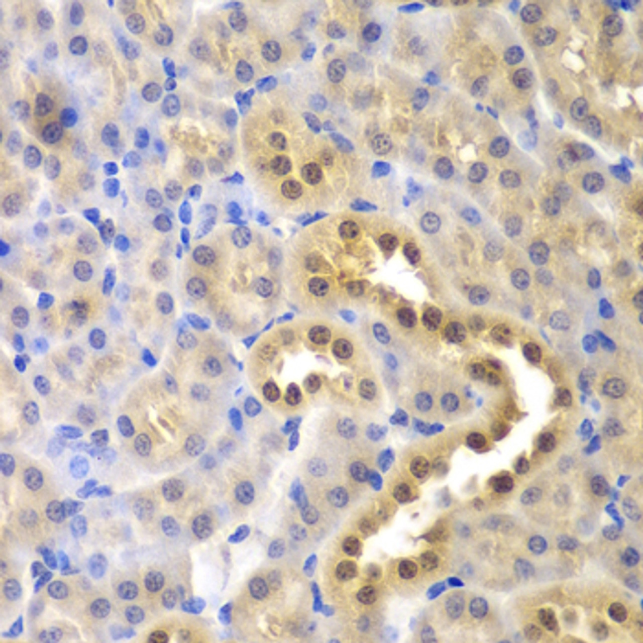Immunohistochemistry of paraffin-embedded mouse kidney using GLO1 antibody (18-395) at dilution of 1:200 (40x lens) .