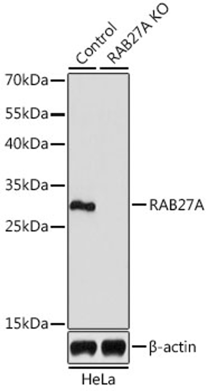 Western blot analysis of extracts from normal (control) and RAB27A knockout (KO) HeLa cells, using RAB27A antibody (18-397) at 1:1000 dilution.<br/>Secondary antibody: HRP Goat Anti-Rabbit IgG (H+L) at 1:10000 dilution.<br/>Lysates/proteins: 25ug per lane.<br/>Blocking buffer: 3% nonfat dry milk in TBST.<br/>Detection: ECL Basic Kit.<br/>Exposure time: 90s.