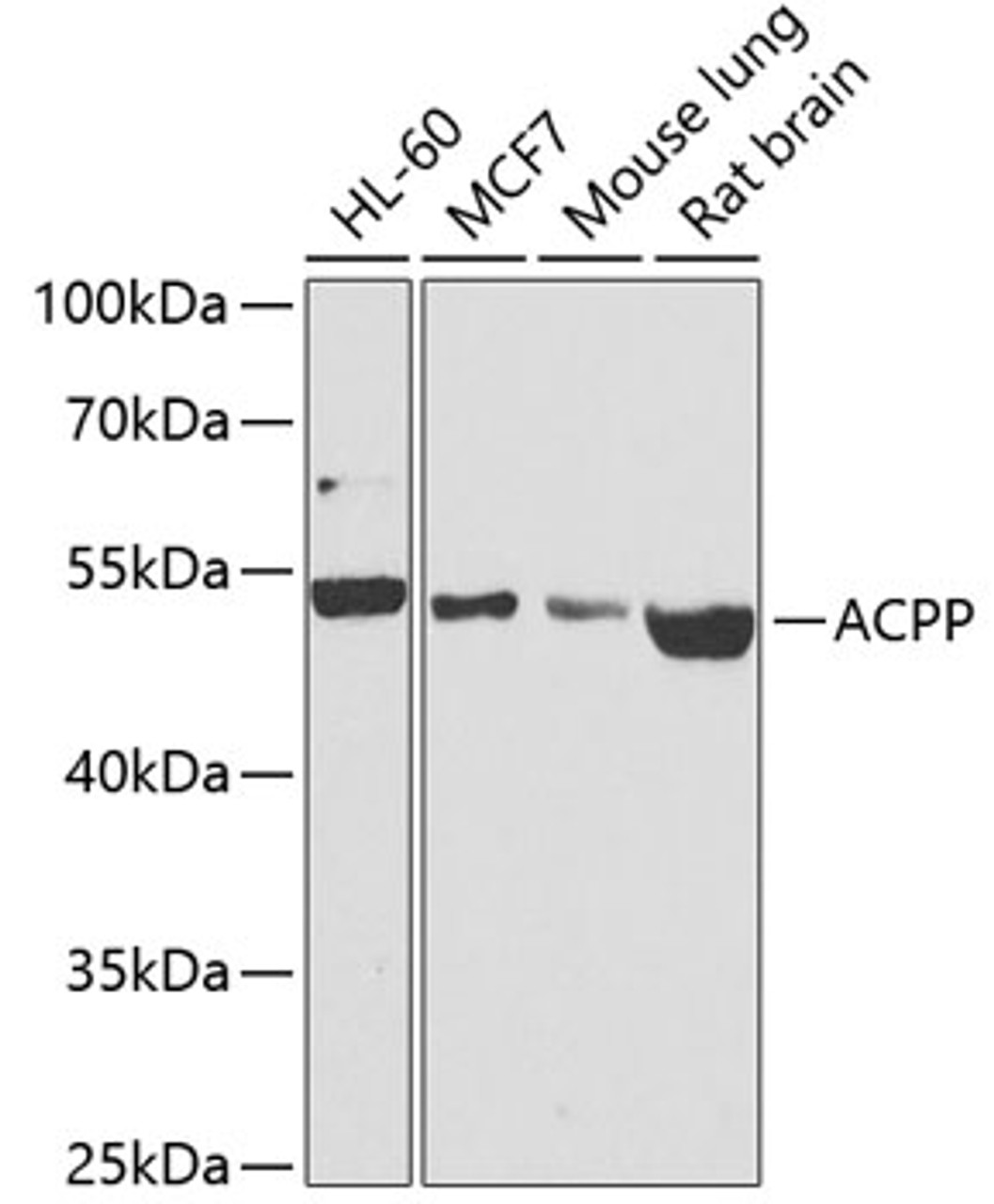 Western blot analysis of extracts of various cell lines, using ACPP antibody (18-400) at 1:1000 dilution.<br/>Secondary antibody: HRP Goat Anti-Rabbit IgG (H+L) at 1:10000 dilution.<br/>Lysates/proteins: 25ug per lane.<br/>Blocking buffer: 3% nonfat dry milk in TBST.<br/>Detection: ECL Basic Kit.<br/>Exposure time: 90s.