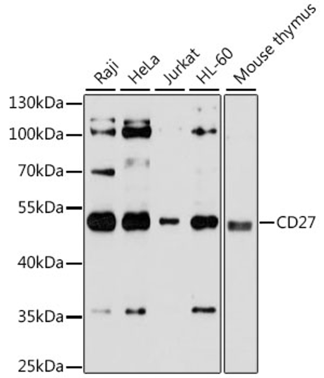 Western blot analysis of extracts of various cell lines, using CD27 antibody (18-404) at 1:3000 dilution.<br/>Secondary antibody: HRP Goat Anti-Rabbit IgG (H+L) at 1:10000 dilution.<br/>Lysates/proteins: 25ug per lane.<br/>Blocking buffer: 3% nonfat dry milk in TBST.<br/>Detection: ECL Basic Kit.<br/>Exposure time: 90s.