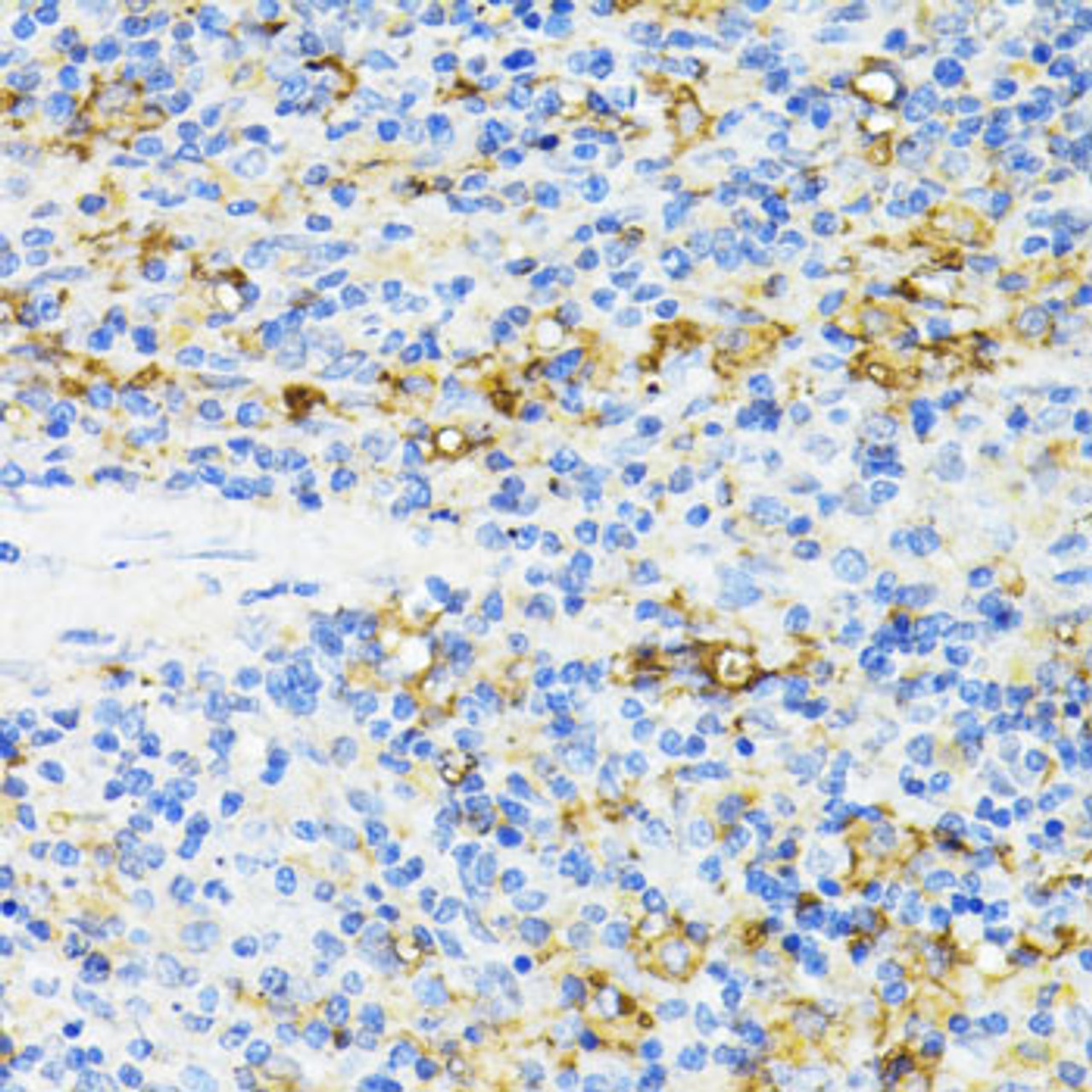 Immunohistochemistry of paraffin-embedded rat spleen using CD27 antibody (18-404) at dilution of 1:100 (40x lens) .