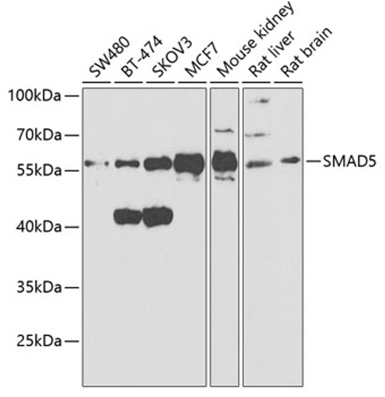 Western blot analysis of extracts of various cell lines, using SMAD5 antibody (18-406) at 1:1000 dilution.<br/>Secondary antibody: HRP Goat Anti-Rabbit IgG (H+L) at 1:10000 dilution.<br/>Lysates/proteins: 25ug per lane.<br/>Blocking buffer: 3% nonfat dry milk in TBST.<br/>Detection: ECL Basic Kit.<br/>Exposure time: 90s.