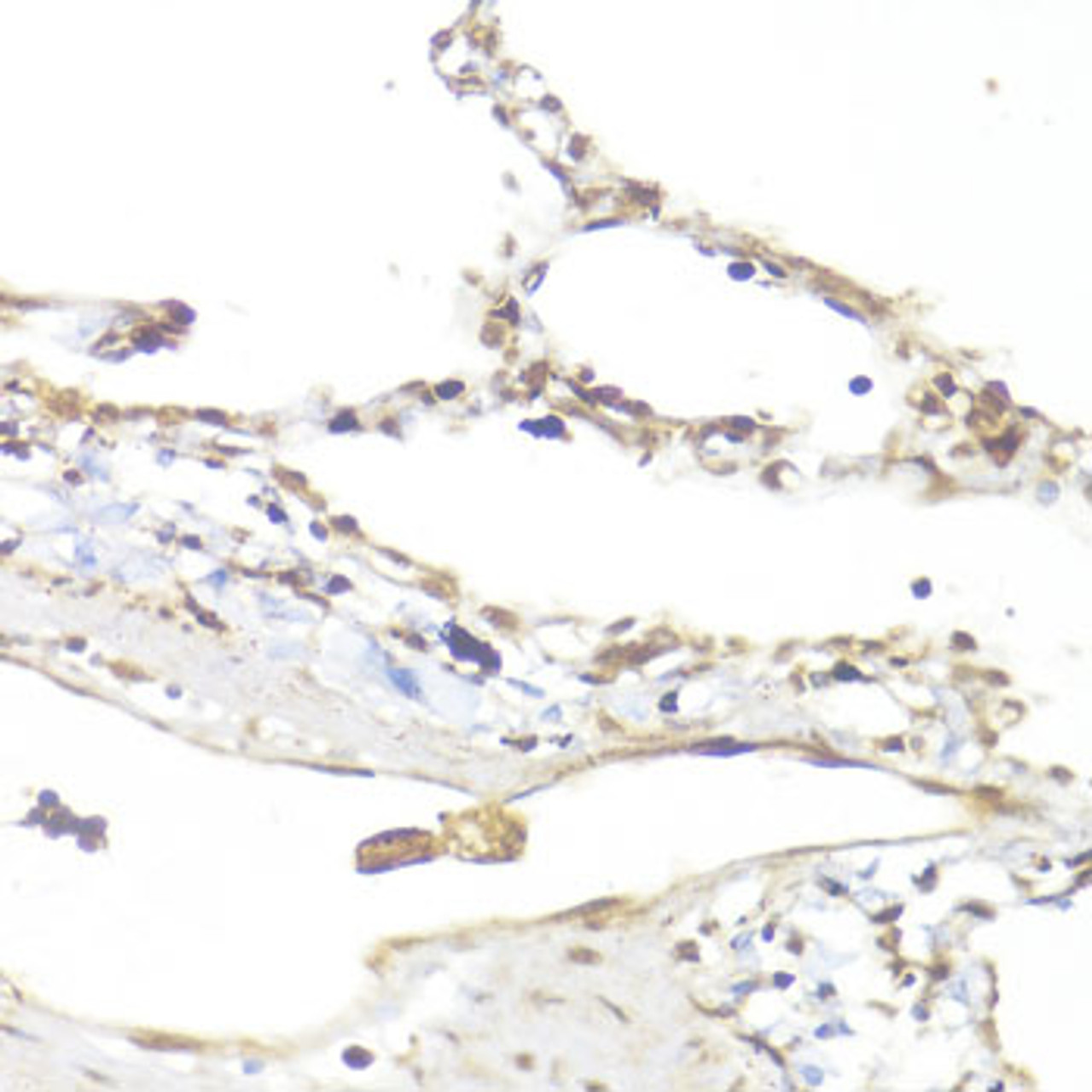 Immunohistochemistry of paraffin-embedded human lung using Smad5 antibody (18-406) at dilution of 1:100 (40x lens) .