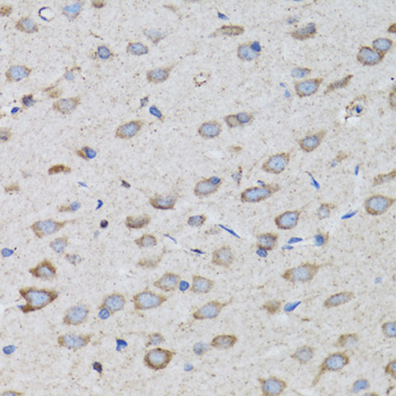 Immunohistochemistry of paraffin-embedded rat brain using PSMD10 antibody (18-408) at dilution of 1:100 (40x lens) .