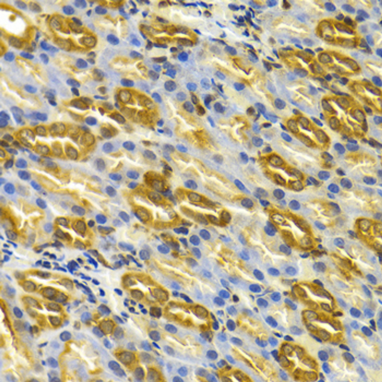 Immunohistochemistry of paraffin-embedded rat kidney using TCP1 antibody (18-409) at dilution of 1:100 (40x lens) .