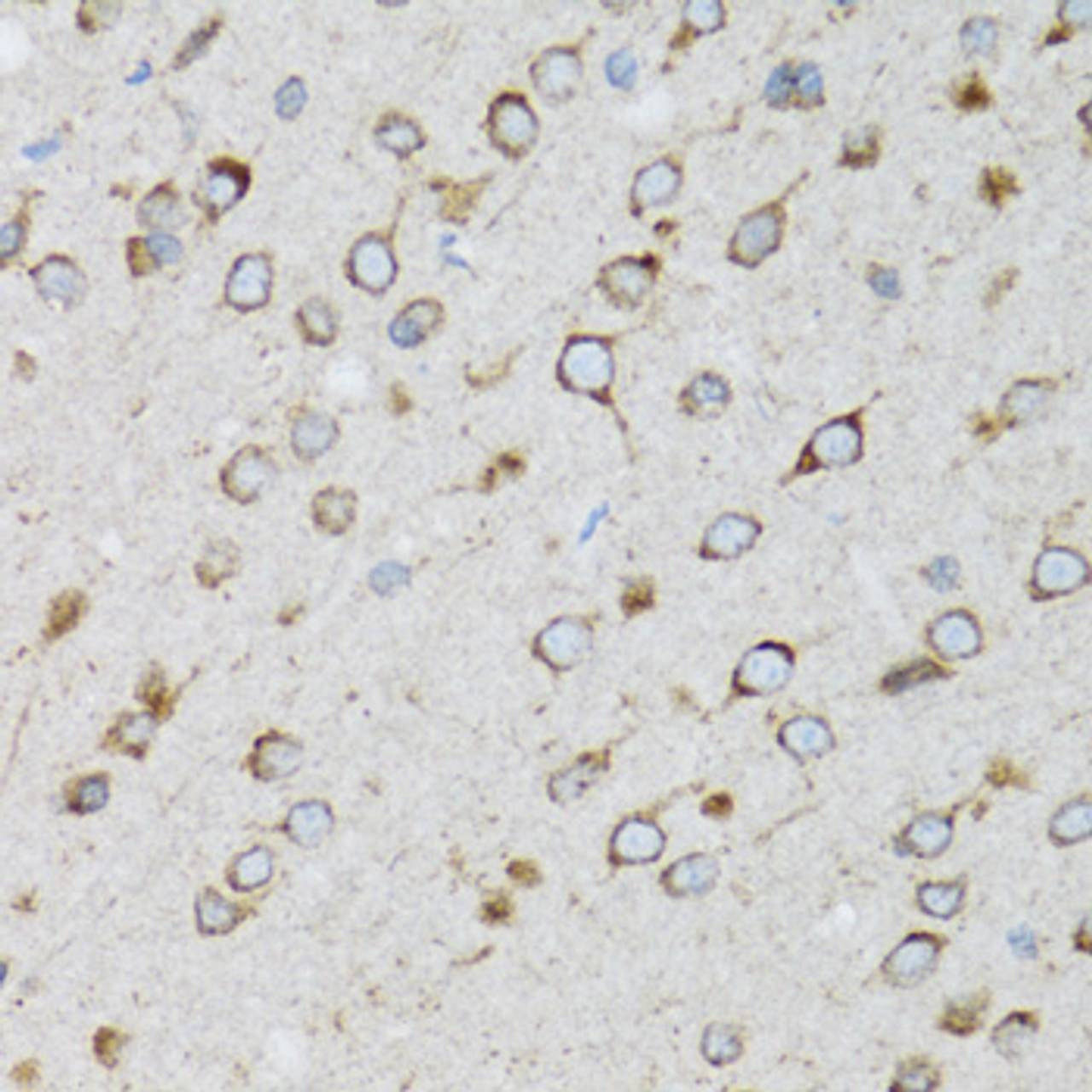 Immunohistochemistry of paraffin-embedded rat brain using UBE2D1 antibody (18-410) at dilution of 1:100 (40x lens) .