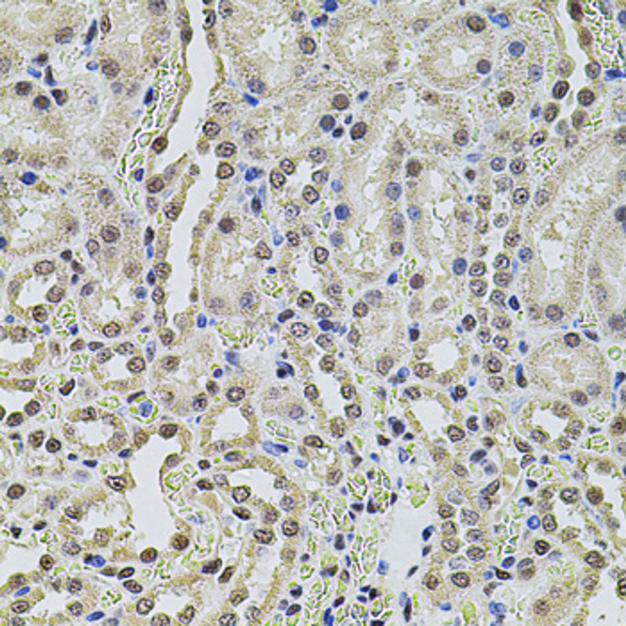 Immunohistochemistry of paraffin-embedded rat kidney using SMARCC2 antibody (18-417) at dilution of 1:100 (40x lens) .