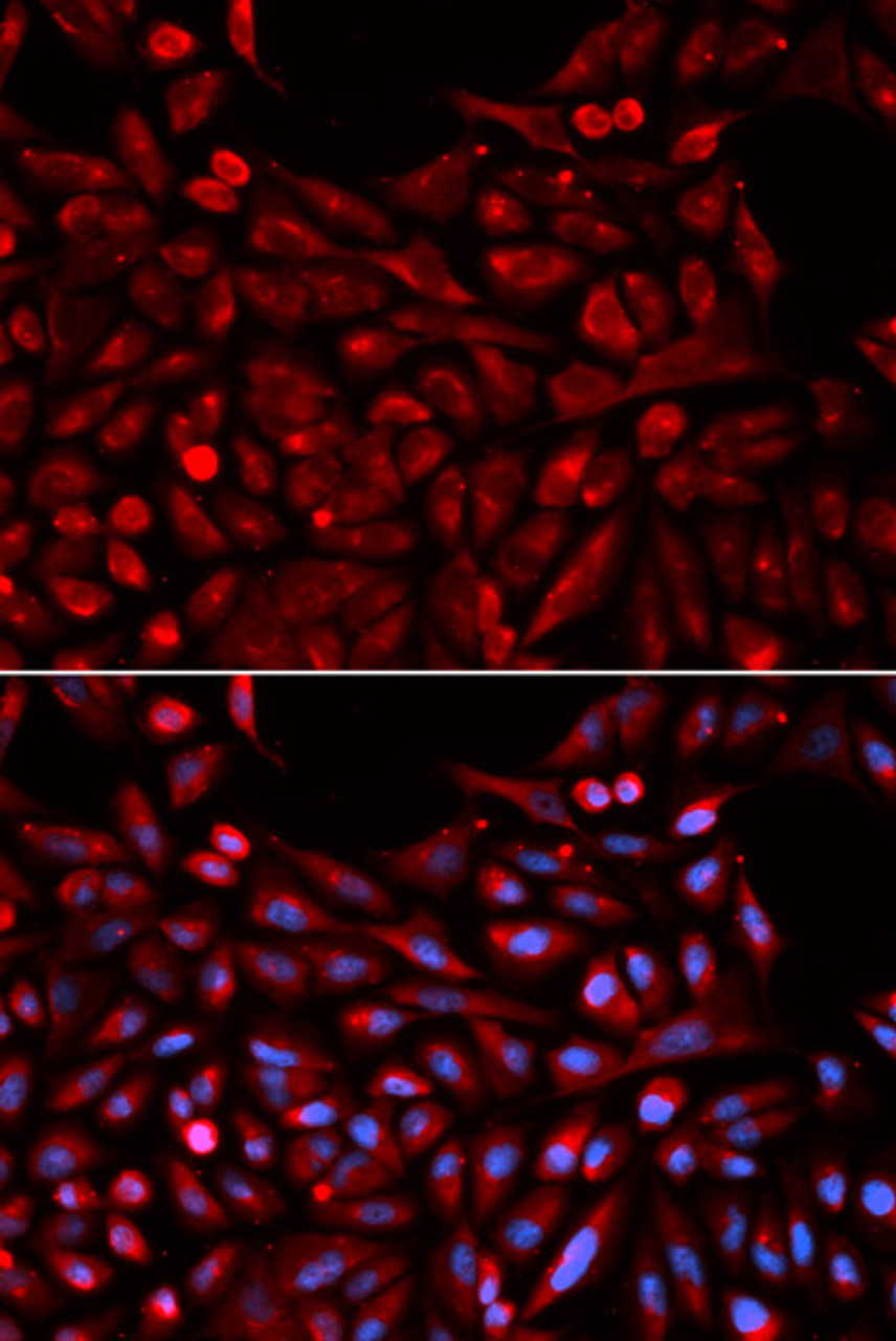 Immunofluorescence analysis of U2OS cells using NR1I3 antibody (18-419) . Blue: DAPI for nuclear staining.