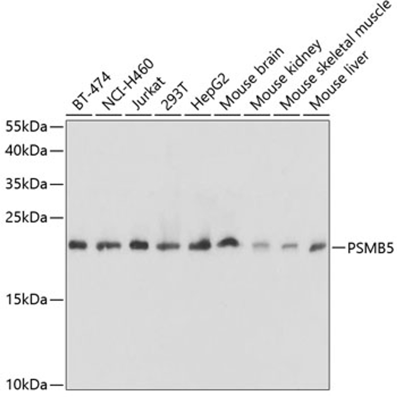 Western blot analysis of extracts of various cell lines, using PSMB5 antibody (18-423) at 1:1000 dilution.<br/>Secondary antibody: HRP Goat Anti-Rabbit IgG (H+L) at 1:10000 dilution.<br/>Lysates/proteins: 25ug per lane.<br/>Blocking buffer: 3% nonfat dry milk in TBST.<br/>Detection: ECL Basic Kit.<br/>Exposure time: 10s.