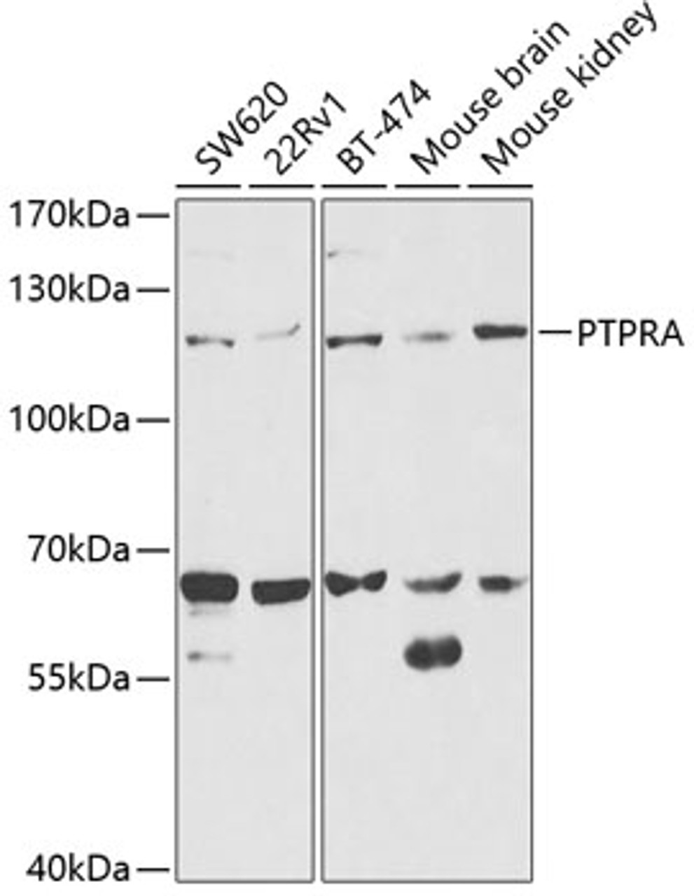 Western blot analysis of extracts of various cell lines, using PTPRA antibody (18-424) at 1:1000 dilution.<br/>Secondary antibody: HRP Goat Anti-Rabbit IgG (H+L) at 1:10000 dilution.<br/>Lysates/proteins: 25ug per lane.<br/>Blocking buffer: 3% nonfat dry milk in TBST.<br/>Detection: ECL Enhanced Kit.<br/>Exposure time: 90s.
