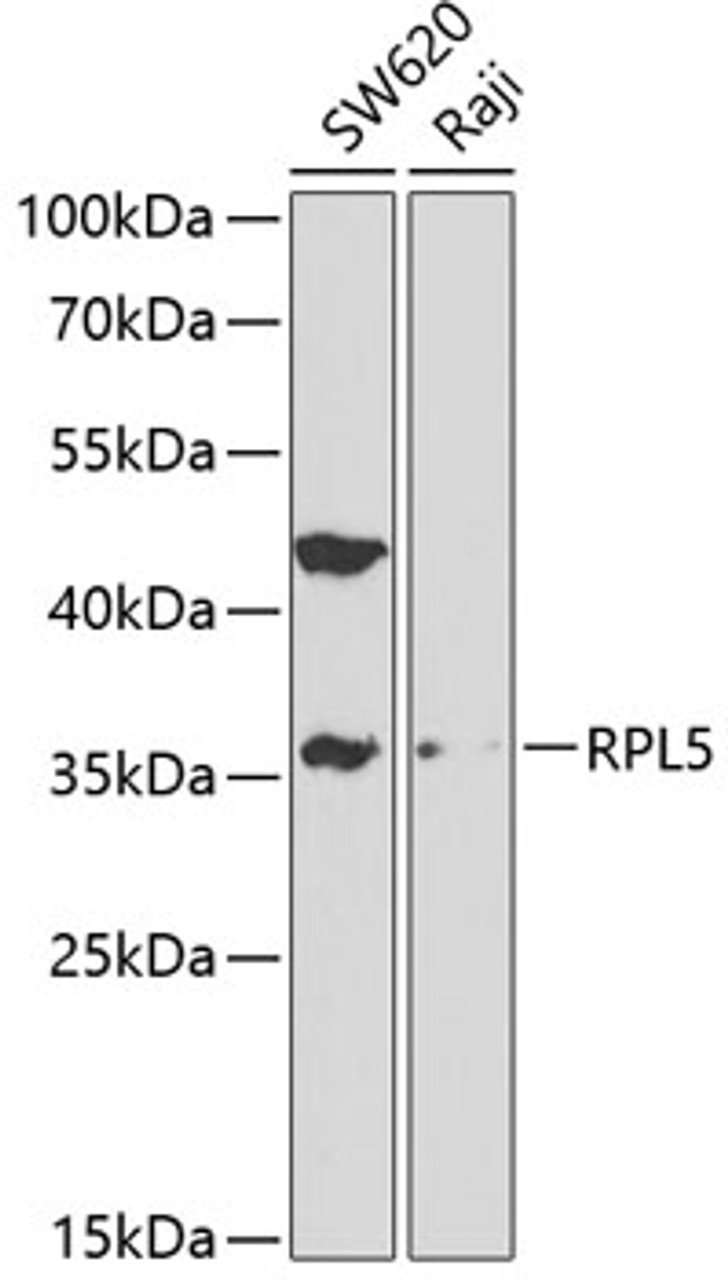 Western blot analysis of extracts of various cell lines, using RPL5 antibody (18-425) at 1:1000 dilution.<br/>Secondary antibody: HRP Goat Anti-Rabbit IgG (H+L) at 1:10000 dilution.<br/>Lysates/proteins: 25ug per lane.<br/>Blocking buffer: 3% nonfat dry milk in TBST.
