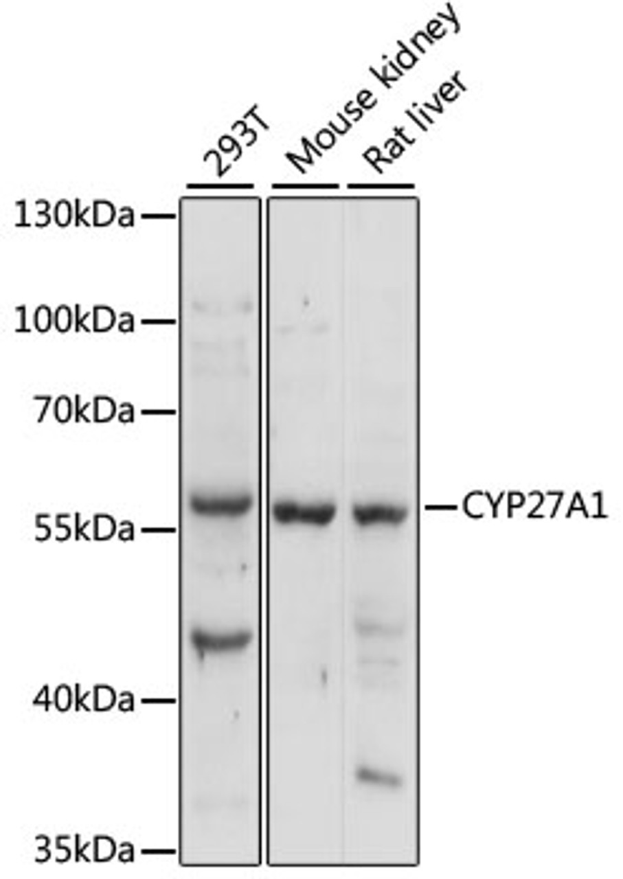 Western blot analysis of extracts of various cell lines, using CYP27A1 antibody (18-429) at 1:1000 dilution.<br/>Secondary antibody: HRP Goat Anti-Rabbit IgG (H+L) at 1:10000 dilution.<br/>Lysates/proteins: 25ug per lane.<br/>Blocking buffer: 3% nonfat dry milk in TBST.<br/>Detection: ECL Basic Kit.<br/>Exposure time: 10s.