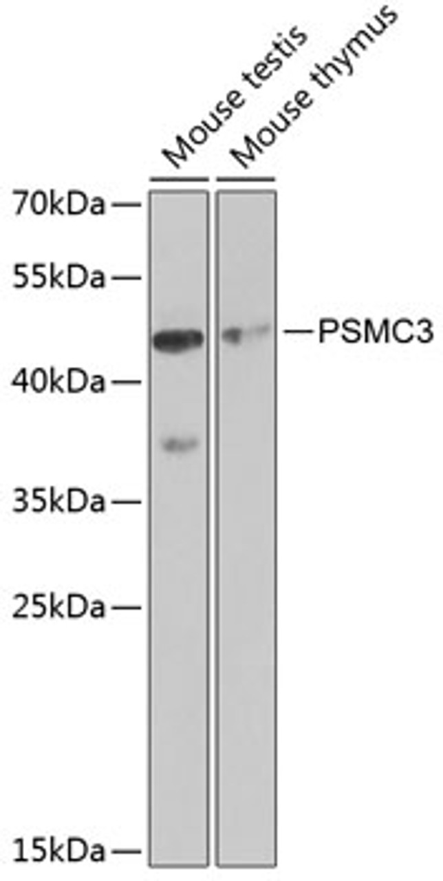 Western blot analysis of extracts of various cell lines, using PSMC3 antibody (18-431) at 1:1000 dilution.<br/>Secondary antibody: HRP Goat Anti-Rabbit IgG (H+L) at 1:10000 dilution.<br/>Lysates/proteins: 25ug per lane.<br/>Blocking buffer: 3% nonfat dry milk in TBST.