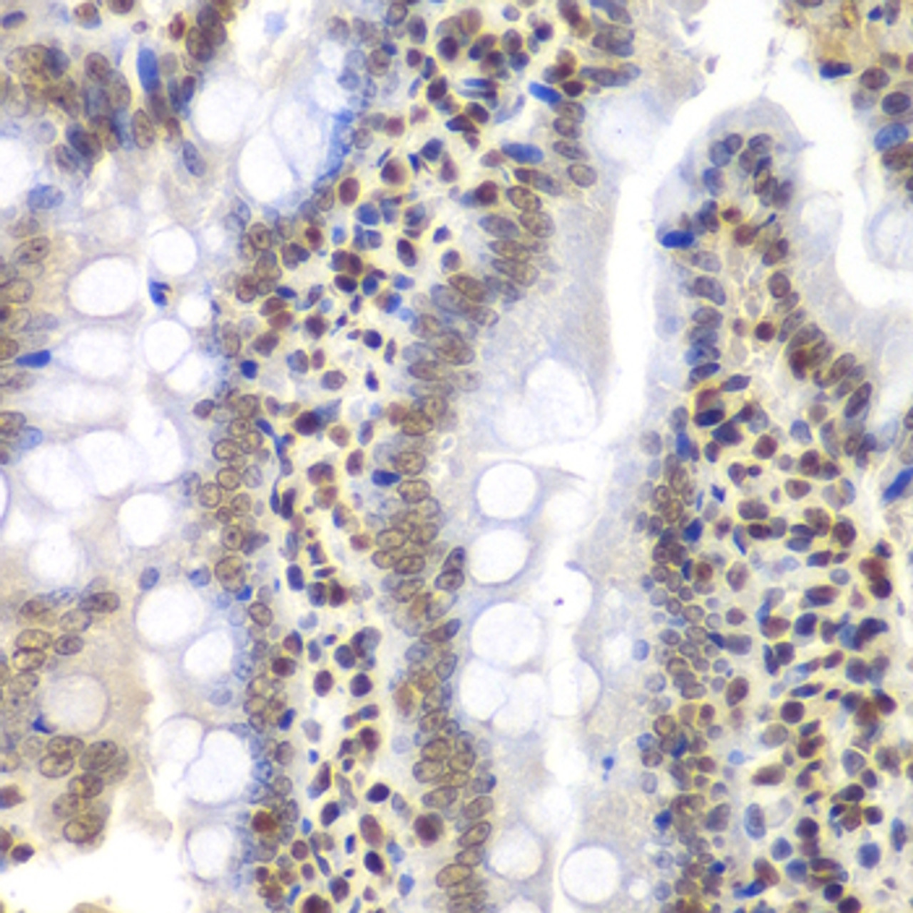 Immunohistochemistry of paraffin-embedded rat intestine using PSMC3 Antibody (18-431) at dilution of 1:200 (40x lens) .