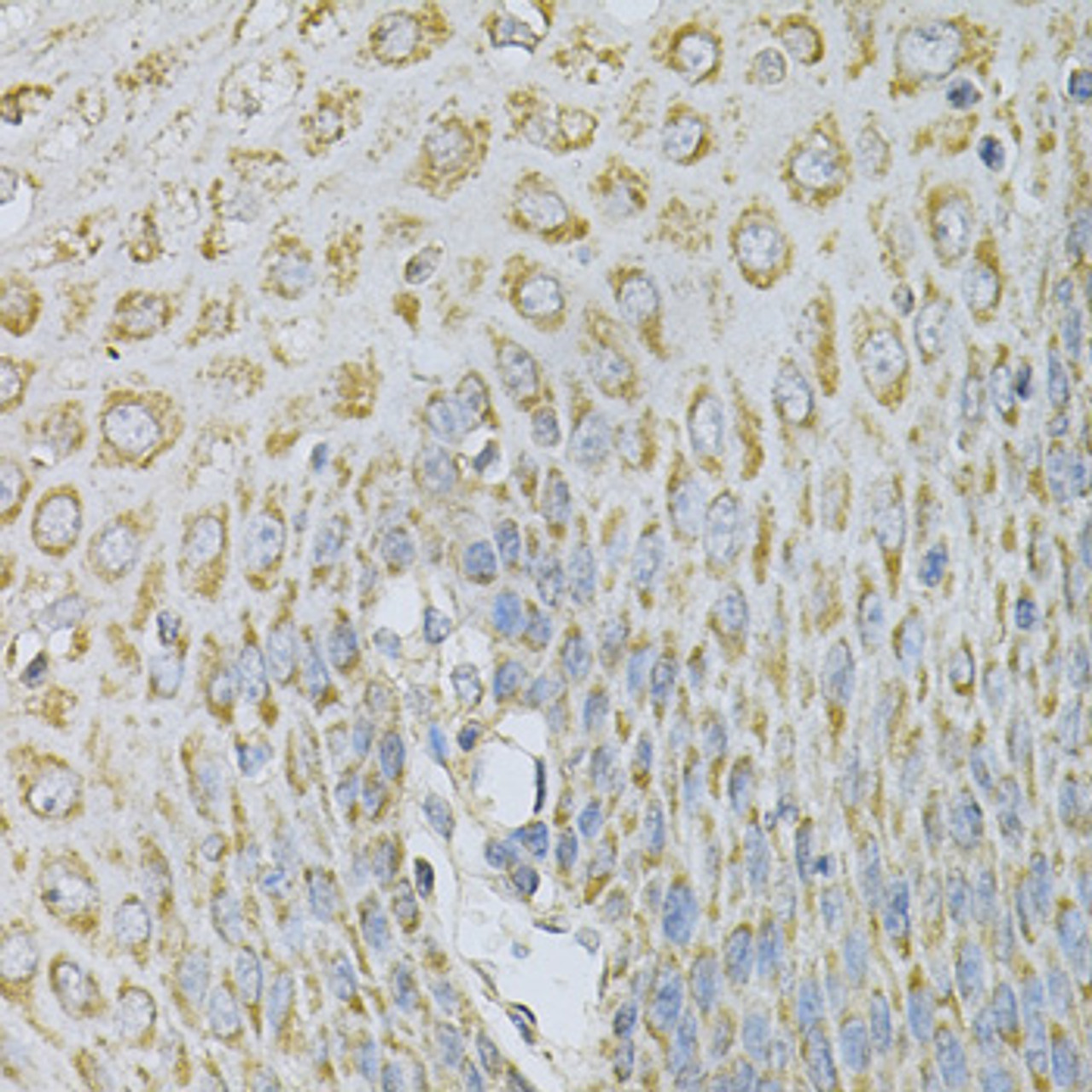 Immunohistochemistry of paraffin-embedded human esophagus using AP2B1 Antibody (18-434) at dilution of 1:100 (40x lens) .