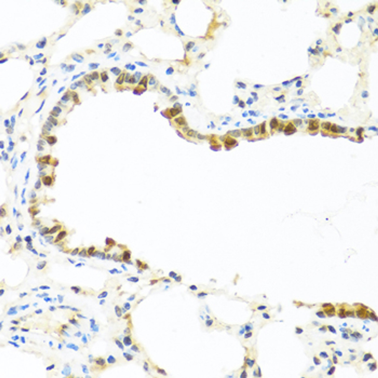 Immunohistochemistry of paraffin-embedded rat lung using APCS antibody (18-435) at dilution of 1:100 (40x lens) .