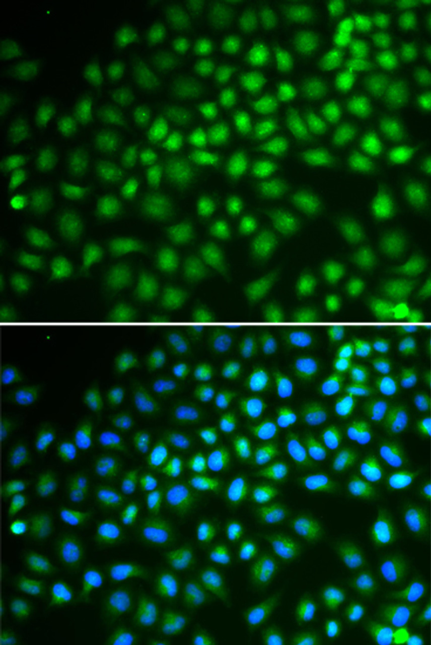 Immunofluorescence analysis of HeLa cells using SMARCA5 antibody (18-437) . Blue: DAPI for nuclear staining.