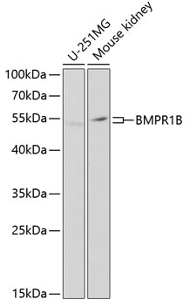 Western blot analysis of extracts of various cell lines, using BMPR1B Antibody (18-442) at 1:1000 dilution.<br/>Secondary antibody: HRP Goat Anti-Rabbit IgG (H+L) at 1:10000 dilution.<br/>Lysates/proteins: 25ug per lane.<br/>Blocking buffer: 3% nonfat dry milk in TBST.<br/>Detection: ECL Basic Kit.