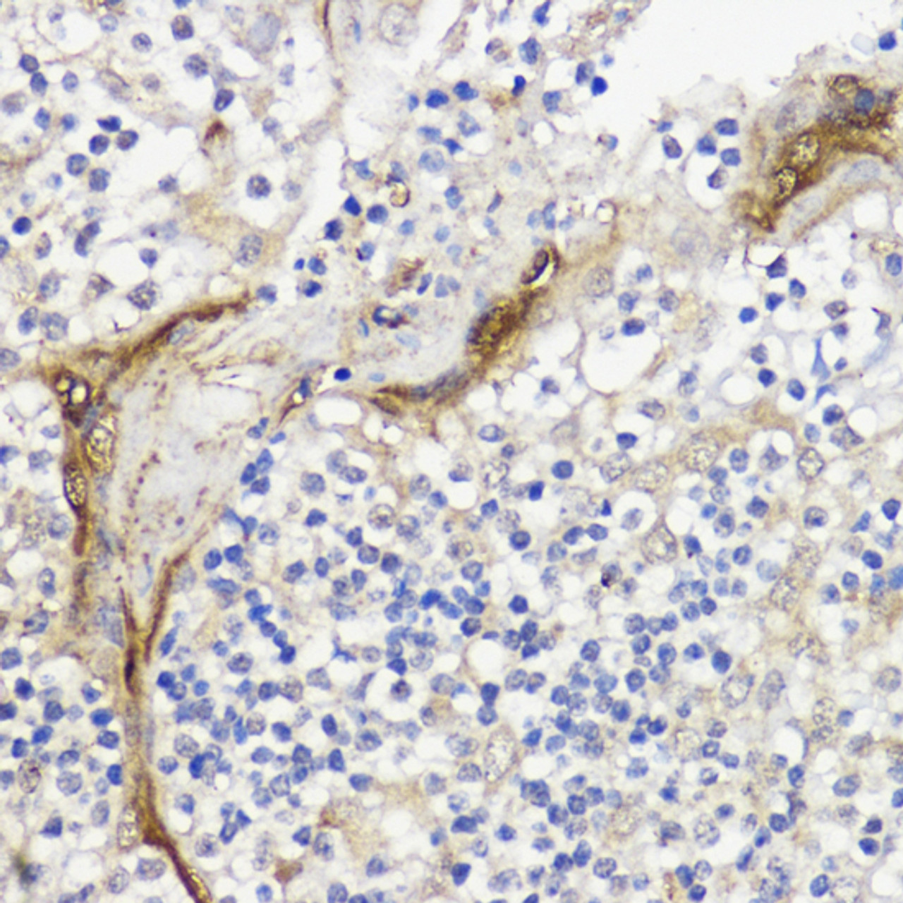 Immunohistochemistry of paraffin-embedded human tonsil using BMPR1B antibody (18-442) at dilution of 1:200 (40x lens) .