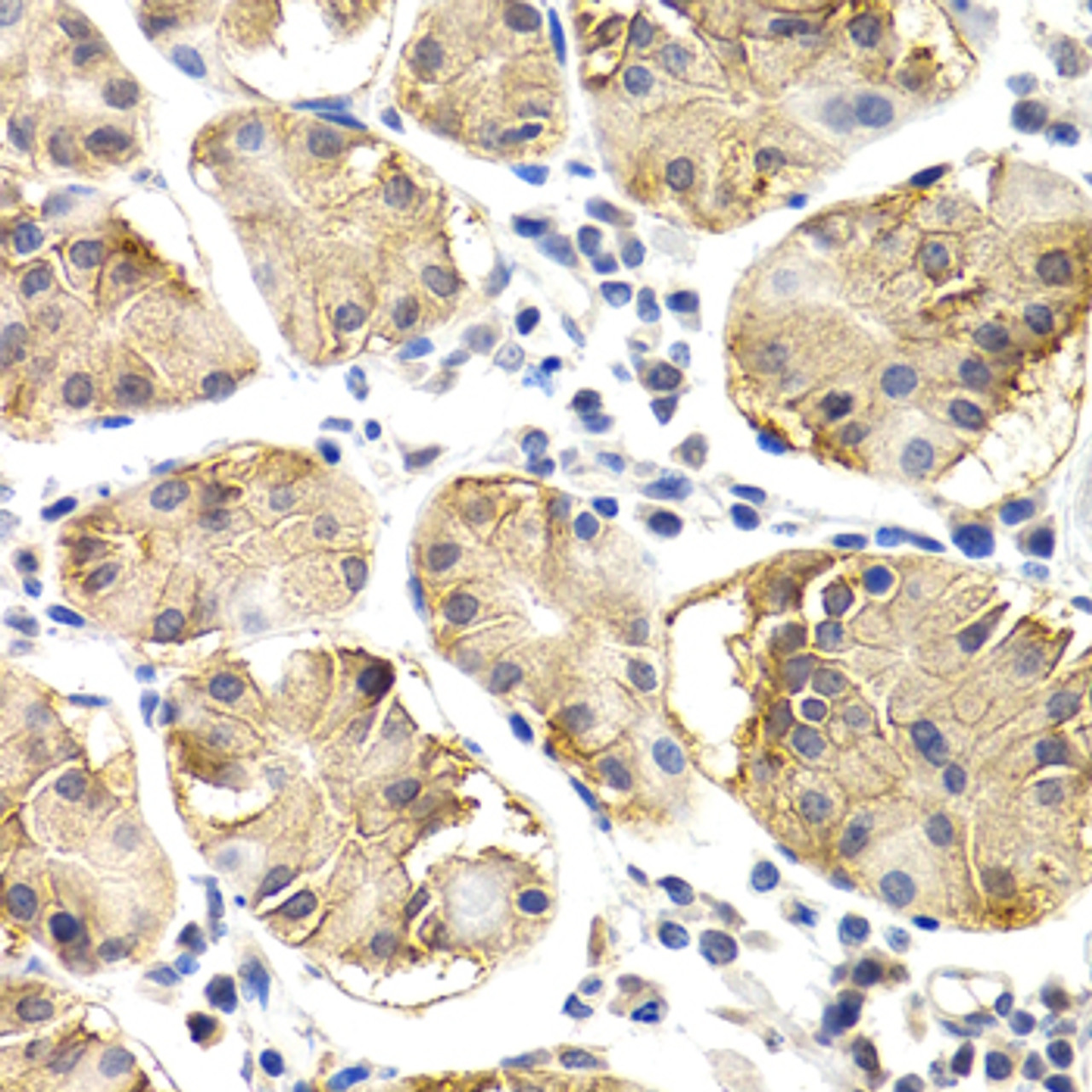 Immunohistochemistry of paraffin-embedded human normal stomach using CHIT1 antibody (18-448) at dilution of 1:200 (40x lens) .