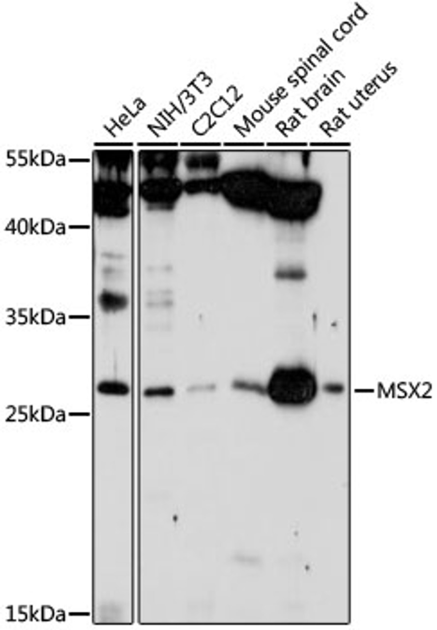 Western blot analysis of extracts of various cell lines, using MSX2 antibody (18-450) at 1:1000 dilution.<br/>Secondary antibody: HRP Goat Anti-Rabbit IgG (H+L) at 1:10000 dilution.<br/>Lysates/proteins: 25ug per lane.<br/>Blocking buffer: 3% nonfat dry milk in TBST.<br/>Detection: ECL Enhanced Kit.<br/>Exposure time: 10s.