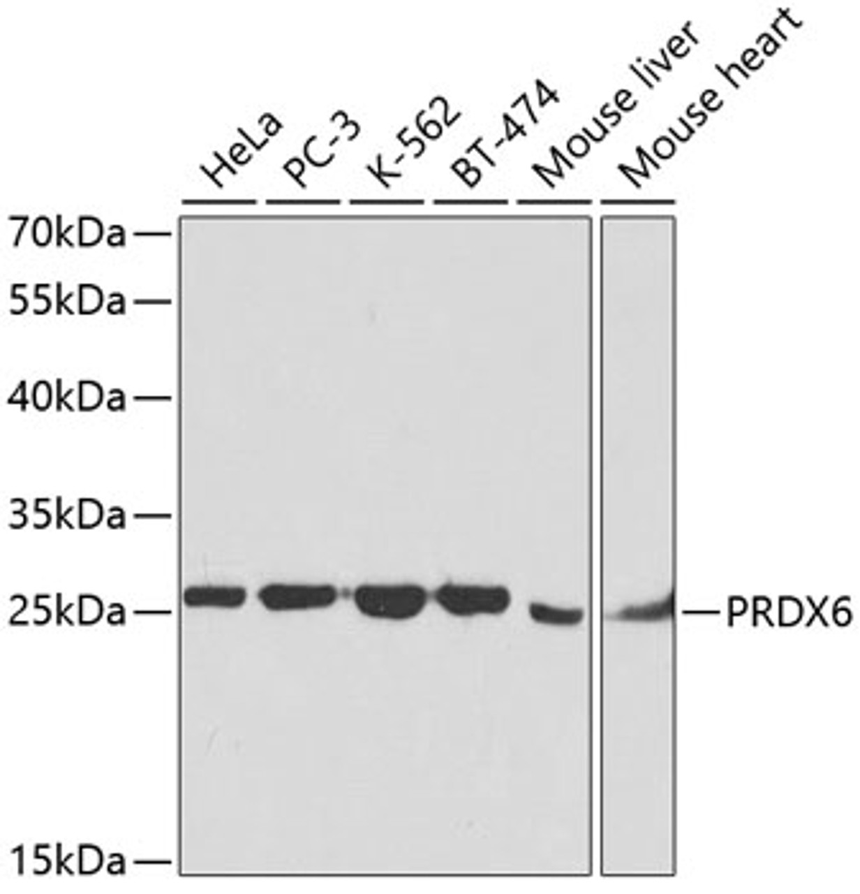 Western blot analysis of extracts of various cell lines, using PRDX6 antibody (18-456) at 1:1000 dilution.<br/>Secondary antibody: HRP Goat Anti-Rabbit IgG (H+L) at 1:10000 dilution.<br/>Lysates/proteins: 25ug per lane.<br/>Blocking buffer: 3% nonfat dry milk in TBST.