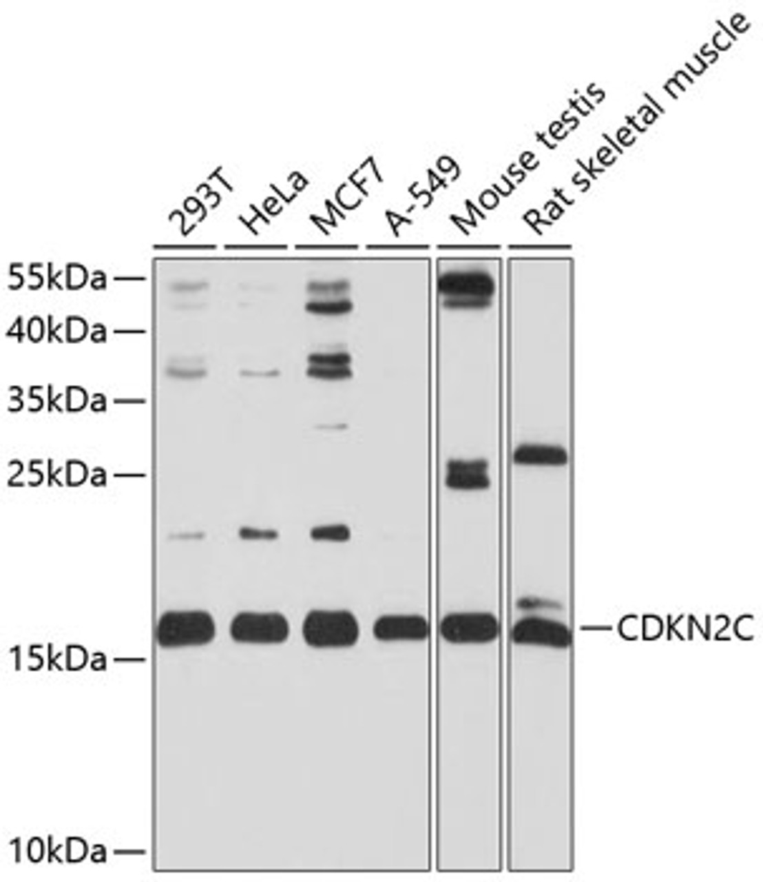 Western blot analysis of extracts of various cell lines, using CDKN2C antibody (18-463) at 1:1000 dilution.<br/>Secondary antibody: HRP Goat Anti-Rabbit IgG (H+L) at 1:10000 dilution.<br/>Lysates/proteins: 25ug per lane.<br/>Blocking buffer: 3% nonfat dry milk in TBST.<br/>Detection: ECL Basic Kit.<br/>Exposure time: 60s.