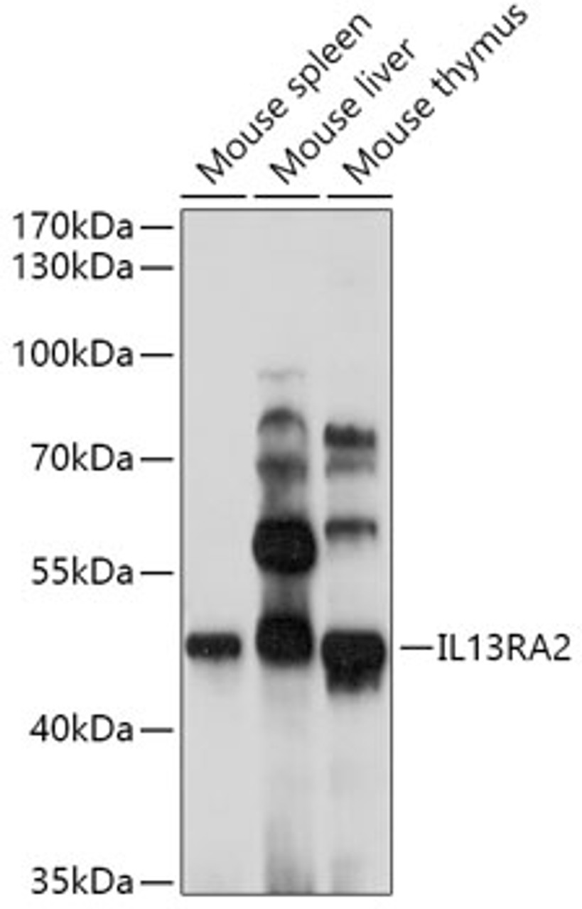 Western blot analysis of extracts of various cell lines, using IL13RA2 antibody (18-464) at 1:1000 dilution.<br/>Secondary antibody: HRP Goat Anti-Rabbit IgG (H+L) at 1:10000 dilution.<br/>Lysates/proteins: 25ug per lane.<br/>Blocking buffer: 3% nonfat dry milk in TBST.<br/>Detection: ECL Basic Kit.<br/>Exposure time: 90s.