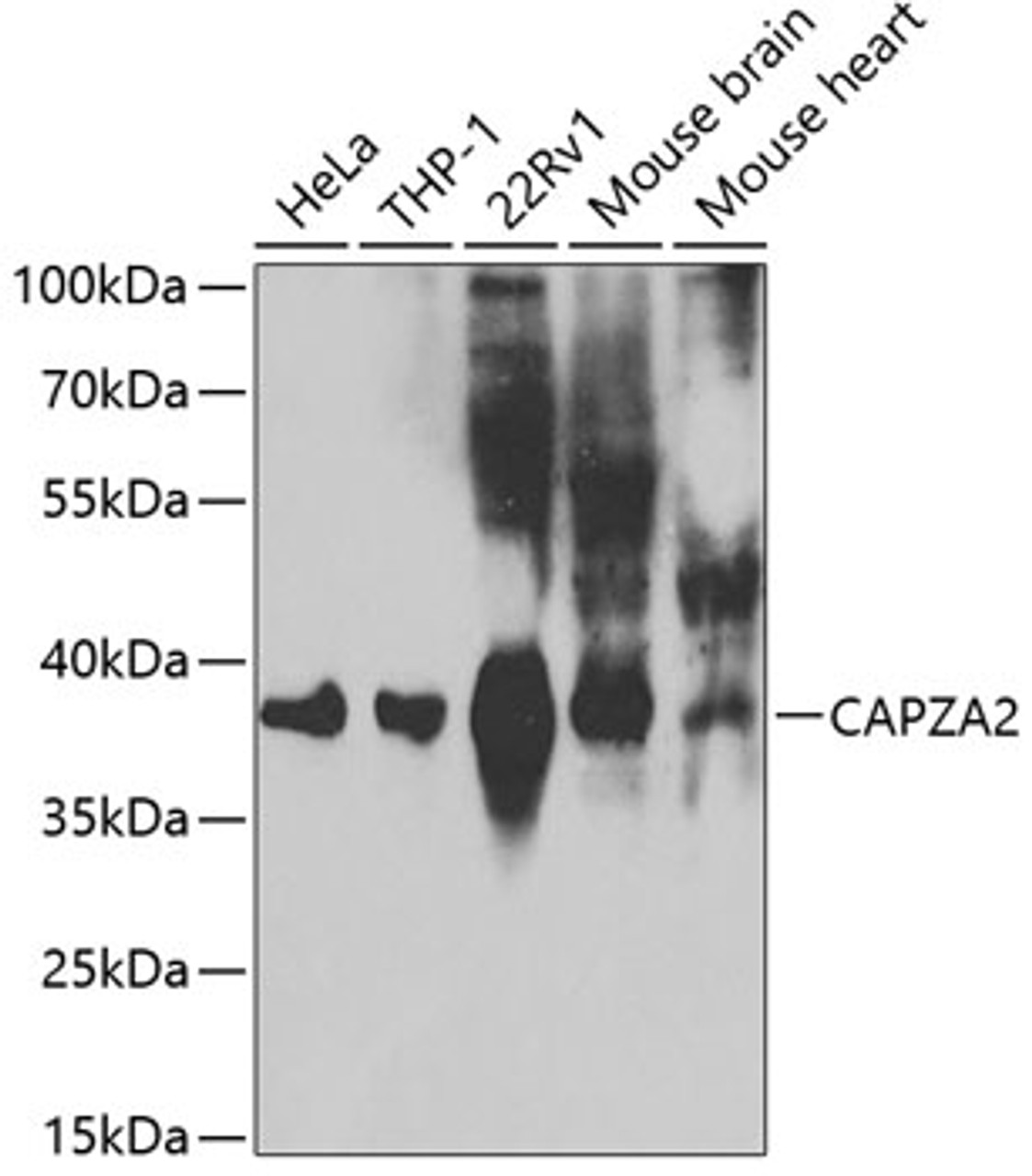 Western blot analysis of extracts of various cell lines, using CAPZA2 antibody (18-469) at 1:1000 dilution.<br/>Secondary antibody: HRP Goat Anti-Rabbit IgG (H+L) at 1:10000 dilution.<br/>Lysates/proteins: 25ug per lane.<br/>Blocking buffer: 3% nonfat dry milk in TBST.