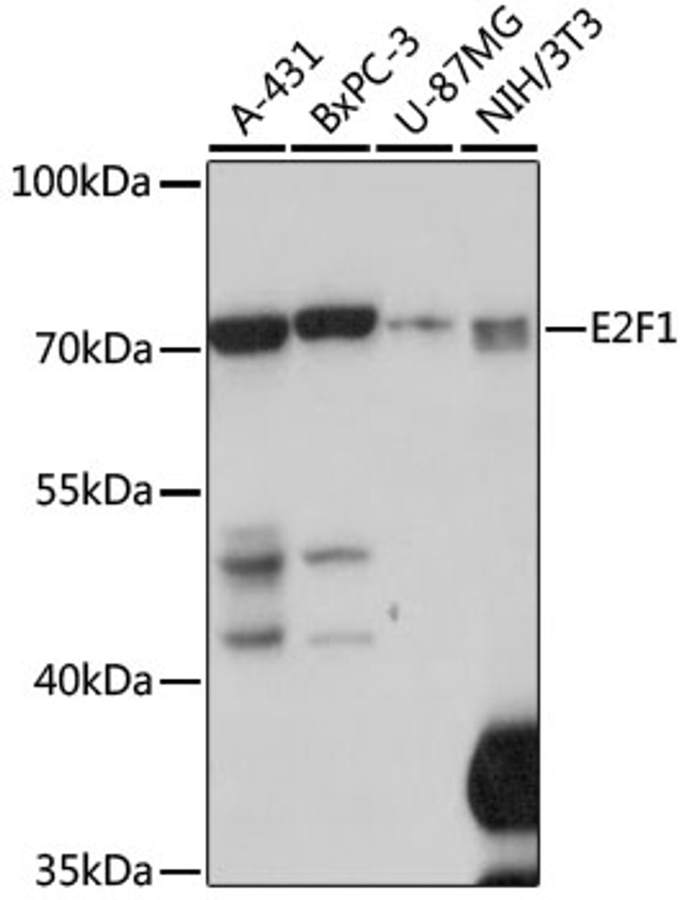 Western blot analysis of extracts of various cell lines, using E2F1 antibody (18-476) at 1:1000 dilution.<br/>Secondary antibody: HRP Goat Anti-Rabbit IgG (H+L) at 1:10000 dilution.<br/>Lysates/proteins: 25ug per lane.<br/>Blocking buffer: 3% nonfat dry milk in TBST.<br/>Detection: ECL Basic Kit.<br/>Exposure time: 10s.