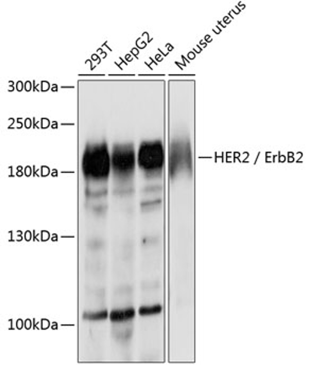 Western blot analysis of extracts of various cell lines, using HER2 / ErbB2 antibody (18-479) at 1:500 dilution.<br/>Secondary antibody: HRP Goat Anti-Rabbit IgG (H+L) at 1:10000 dilution.<br/>Lysates/proteins: 25ug per lane.<br/>Blocking buffer: 3% nonfat dry milk in TBST.<br/>Detection: ECL Basic Kit.<br/>Exposure time: 90s.