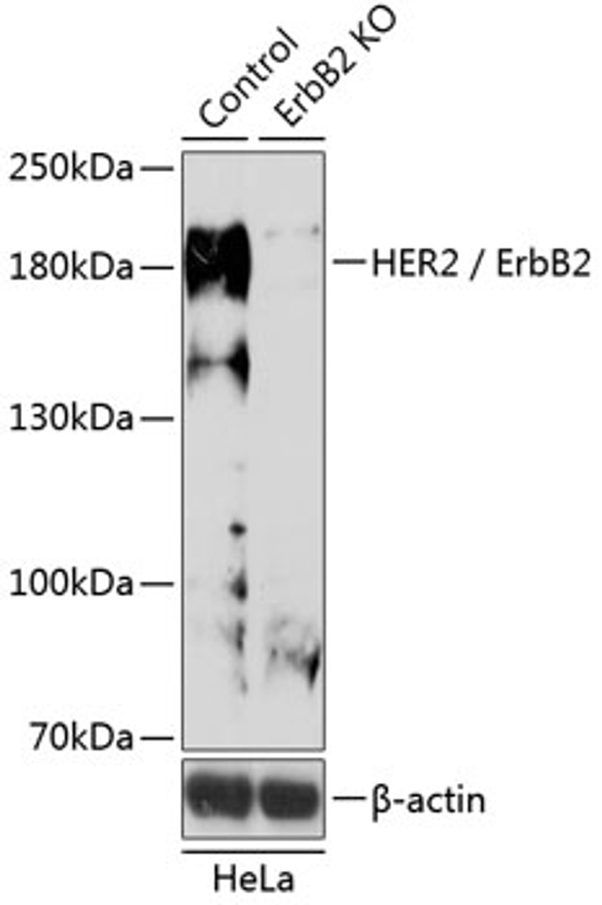 Western blot analysis of extracts from normal (control) and HER2 / ErbB2 knockout (KO) HeLa cells, using HER2 / ErbB2 antibody (18-479) at 1:500 dilution.<br/>Secondary antibody: HRP Goat Anti-Rabbit IgG (H+L) at 1:10000 dilution.<br/>Lysates/proteins: 25ug per lane.<br/>Blocking buffer: 3% nonfat dry milk in TBST.<br/>Detection: ECL Basic Kit.<br/>Exposure time: 5min.