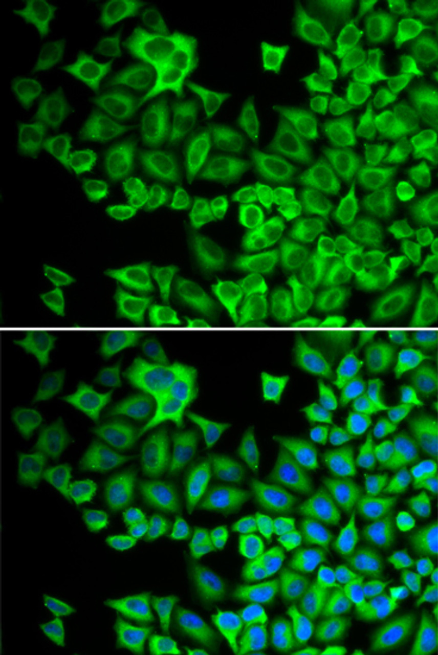 Immunofluorescence analysis of A549 cells using HCK antibody (18-487) . Blue: DAPI for nuclear staining.